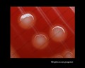 streptococcus pyogenes